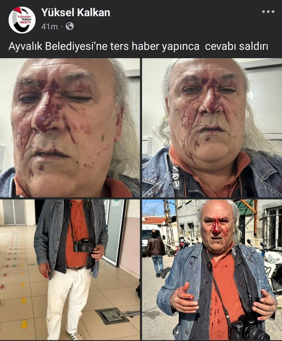 Yerel gazeteci darp edildi, usulsüzlükleri haberleştirdi